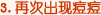 3.�ٴγ��ֶ���
