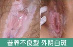 ͼƬ������....