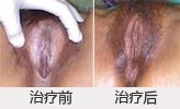 ͼƬ������....
