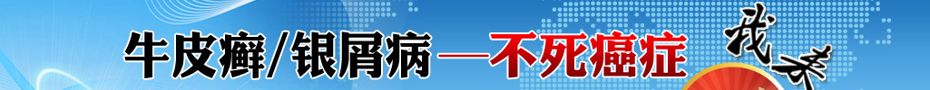 牛皮癣&mdash;不死癌症，我来了